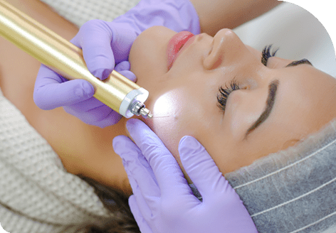 Get Natural Look with Mole Removal Treatment in Leeds