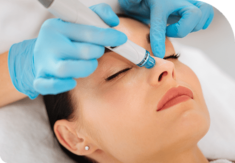 Deep Cleansing and Exfoliation of the Skin with Hydrafacial MD Treatment in Leeds​