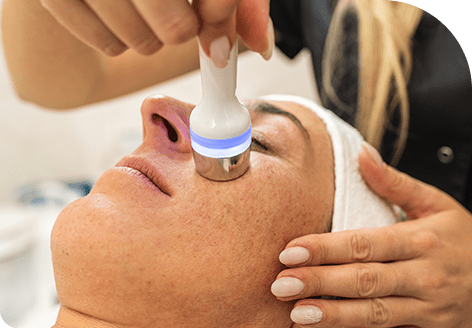 Painless Extraction of Blackheads and Whiteheads with Hydrafacial MD Treatment in Leeds​