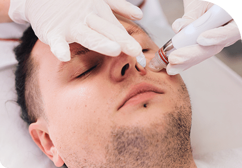 Safe and Suitable for All Skin Types, Including Sensitive Skin with Hydrafacial MD Treatment in Leeds​