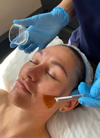 Chemical Peel Treatment in Leeds
