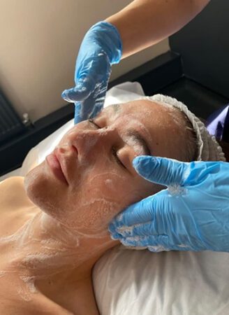 Chemical Peel Treatment in Leeds
