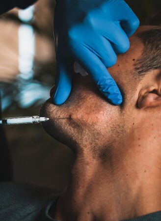 Dermal Fillers Treatment for Men in Leeds
