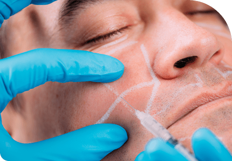 Permanent Hair Reduction with Laser Hair Removal Treatment in Leeds