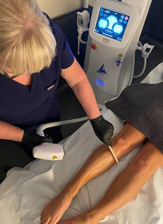 Laser Hair Removal Treatment with PermaICE in Leeds​