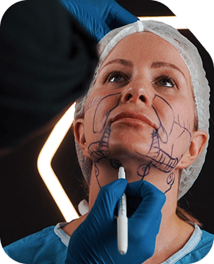 My Ellevate Neck Tightening