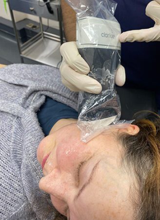 Facial Ultrasound 191 Ultrasound Facial Treatment in Leeds