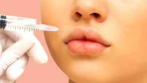 2 ml Russian Lip Filler