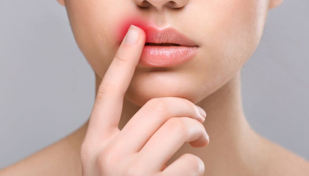 A Guide to Lip Filler Healing Process