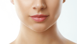 Russian Lip Filler on Thin Lips