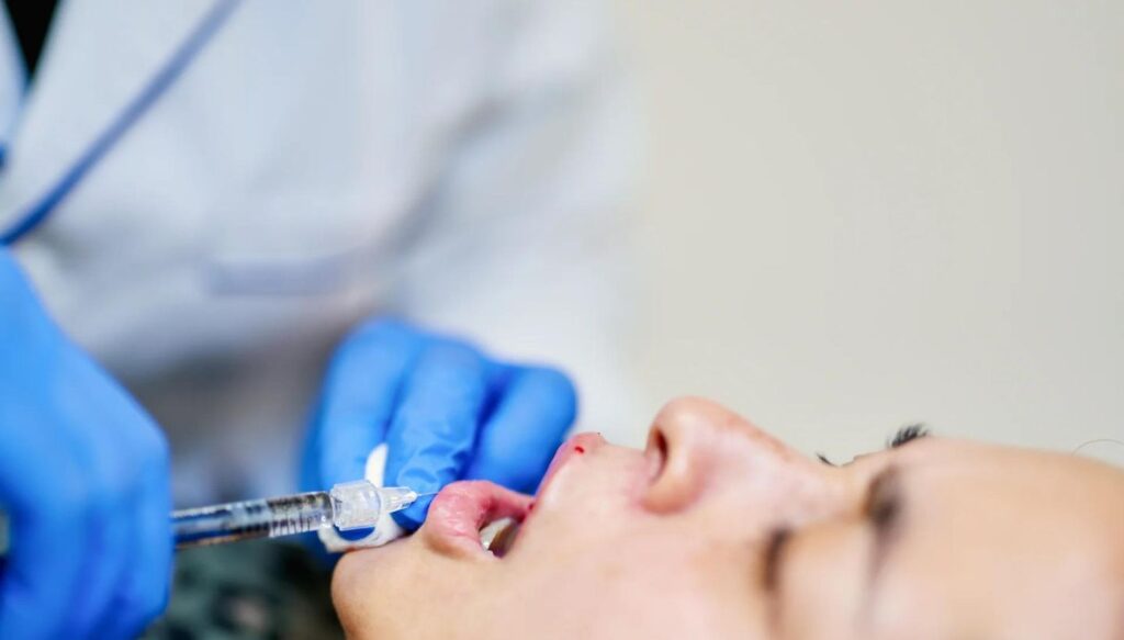 Lip Filler Healing Process