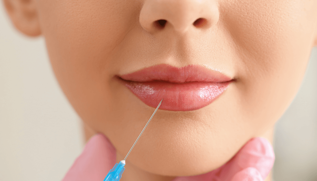 Learn Everything About the Russian Lip Filler Technique
