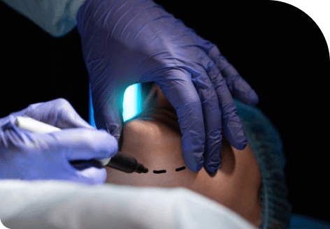 Double Chin 39 Image 16