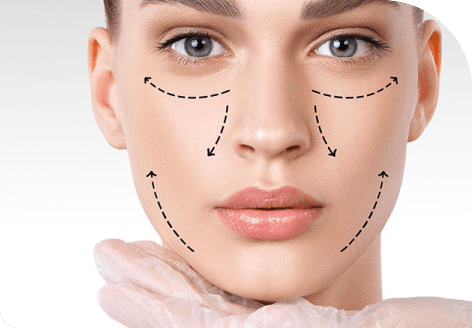 Nasolabial folds and Marionette lines 41 Image 18