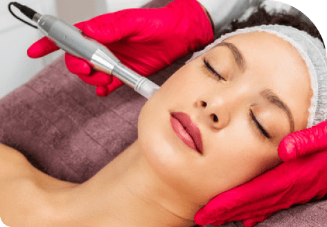 Nasolabial folds and Marionette lines 42 Image 19