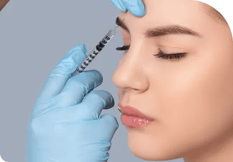 Nasolabial folds and Marionette lines 40 Image 21