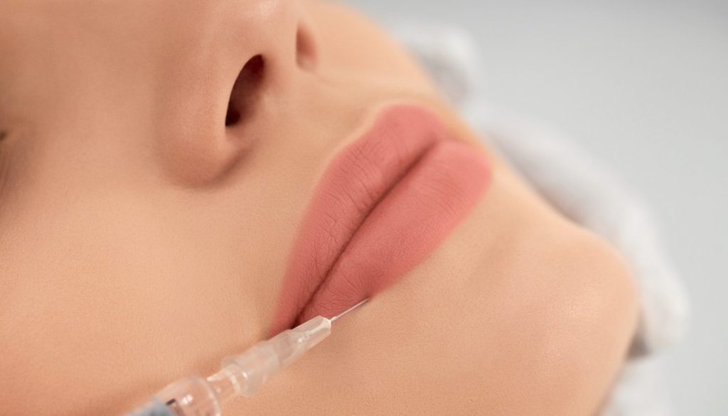 How Long Does it Take for Lip Filler to Settle? A Day-by-Day Breakdown