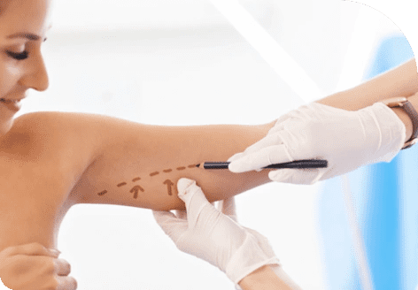 Arm Laxity 42 Image 37