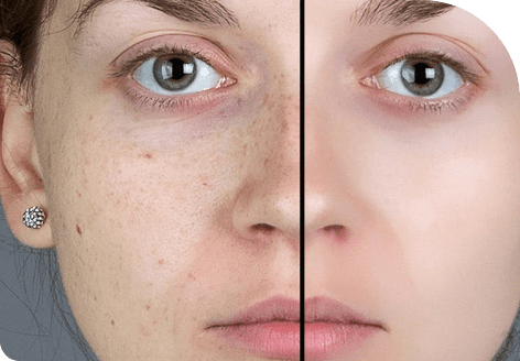 Morpheus8 69 Image 42