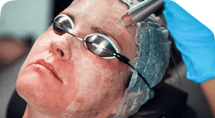 Ectropion Surgery 102 Rectangle 4478 1 19 1