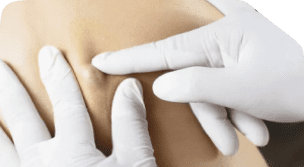 Ectropion Surgery 103 Rectangle 4478 1 20 1