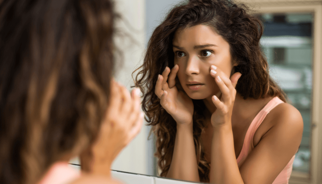 How to Remove Dark Circles Under Eyes Permanently ?