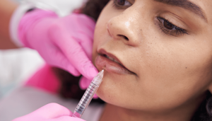 Lip Filler