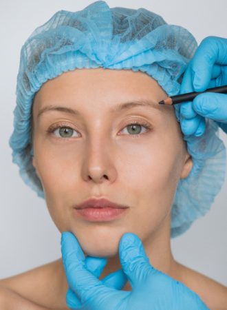 Brow Lift Surgery by Dr. Jeeva