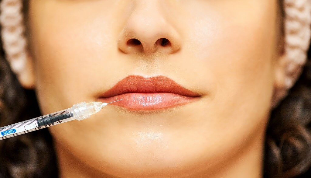 1 ml Lip Filler: Here Is What You Need To Know