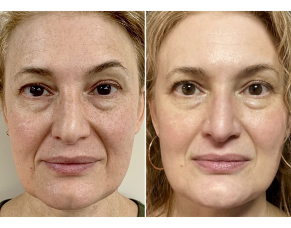 Forma Plus 121 Forma YSC 2 1