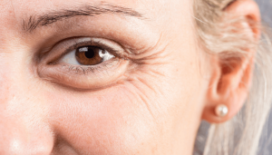 How to get rid of eye bags