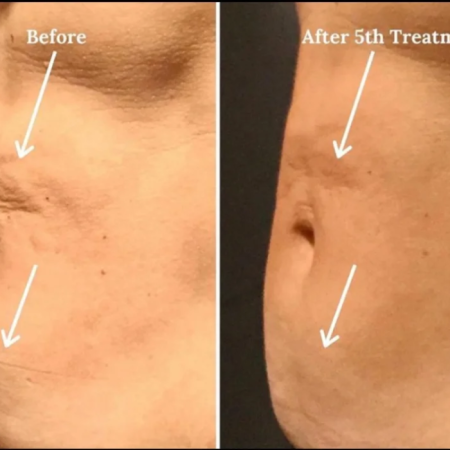 BodytitebeforeAfter 1