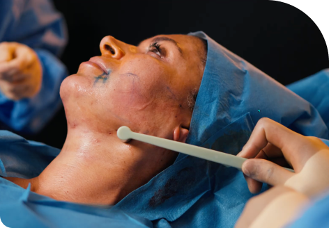 Signature Lift 76 Signature Lift Treatment by Dr Raj Thethi