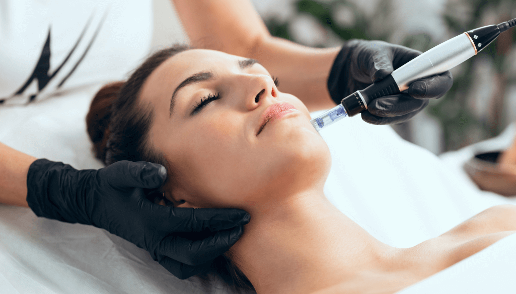 Morpheus8 treatment for uneven skin tone