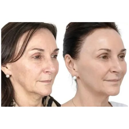 Neogen Plasma 97 Neogen4 1 1