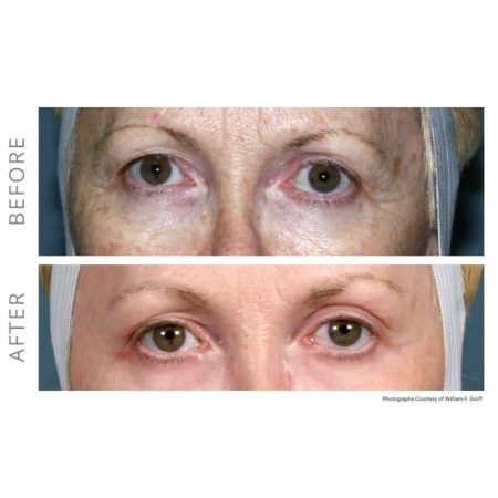 Neogen Plasma 96 Neogen4 1