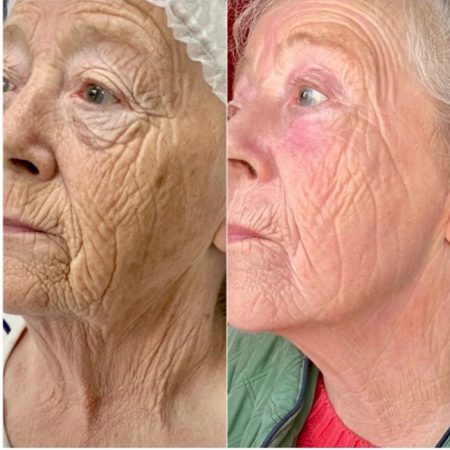 Neogen Plasma 103 Neogen4 1 7