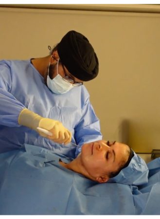 Signature Lift 56 Signature Lift Treatment done by Dr Raj Thethi