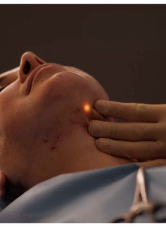 Signature Lift 54 YSC Signature Lift : Customised Facial Sculpting Treatment