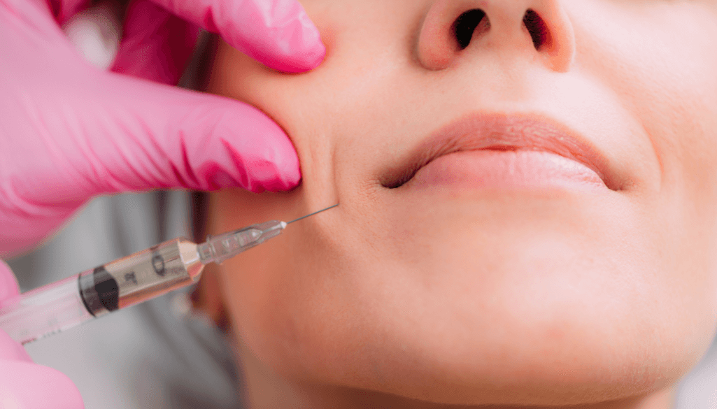 What are Jowls: Causes, Symptoms, andPrevention 5 Dermal Fillers to get rid of jowls