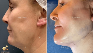 How To Get A Sharper Jawline