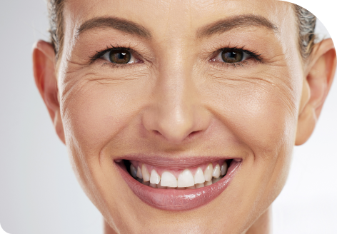 Under Eye Bags 46 Image