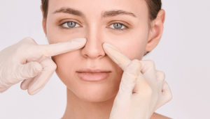 Nose Filler Gone Wrong