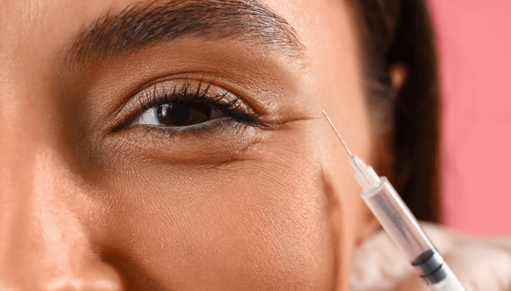 Tear Trough Filler Gone Wrong