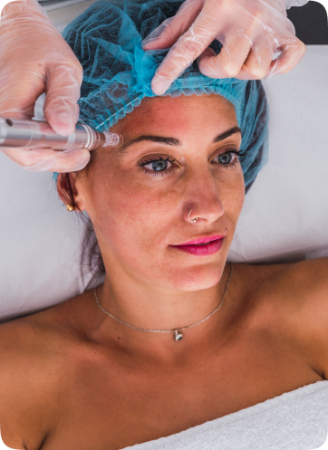 Temple Fillers 68 Temple Filler