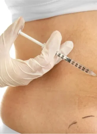 fat dissolving injections