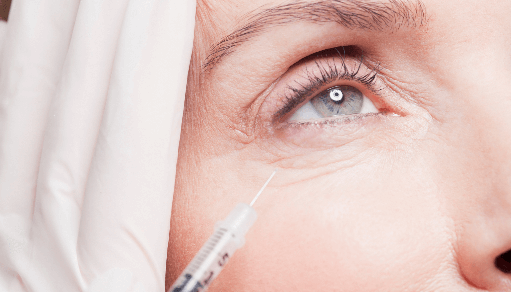 How Long Does Tear Trough Filler Last?