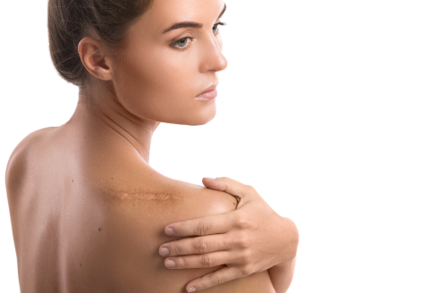 Scar Revision 111 Image 41