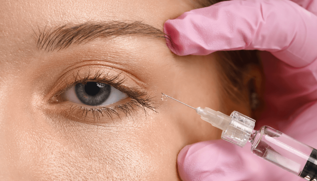 Tear Trough Filler Swelling Stages: A Guide on Timeline