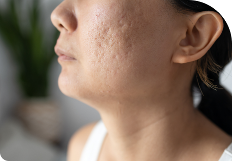 Scar Revision 110 boosts confidence 2